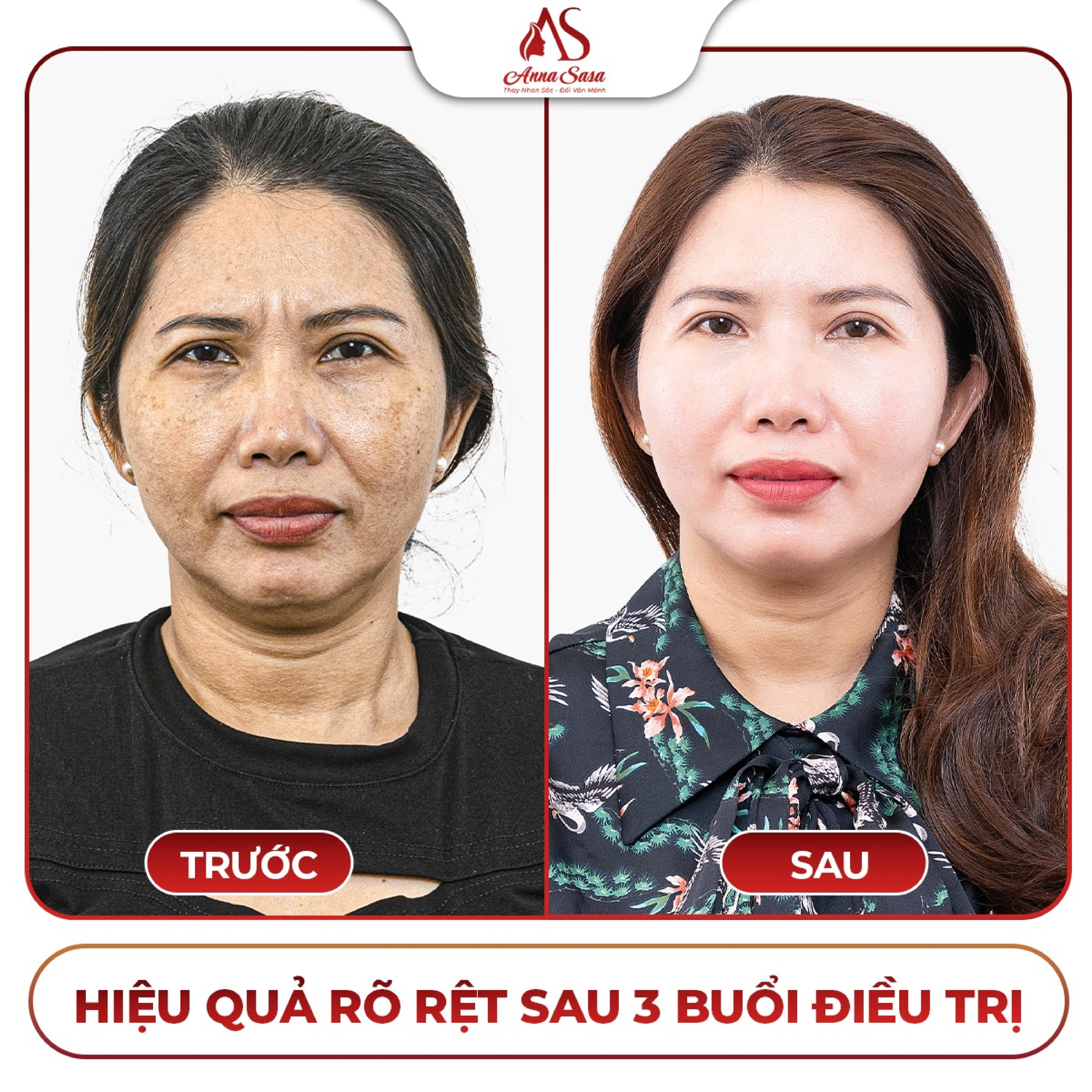 kem chống nắng