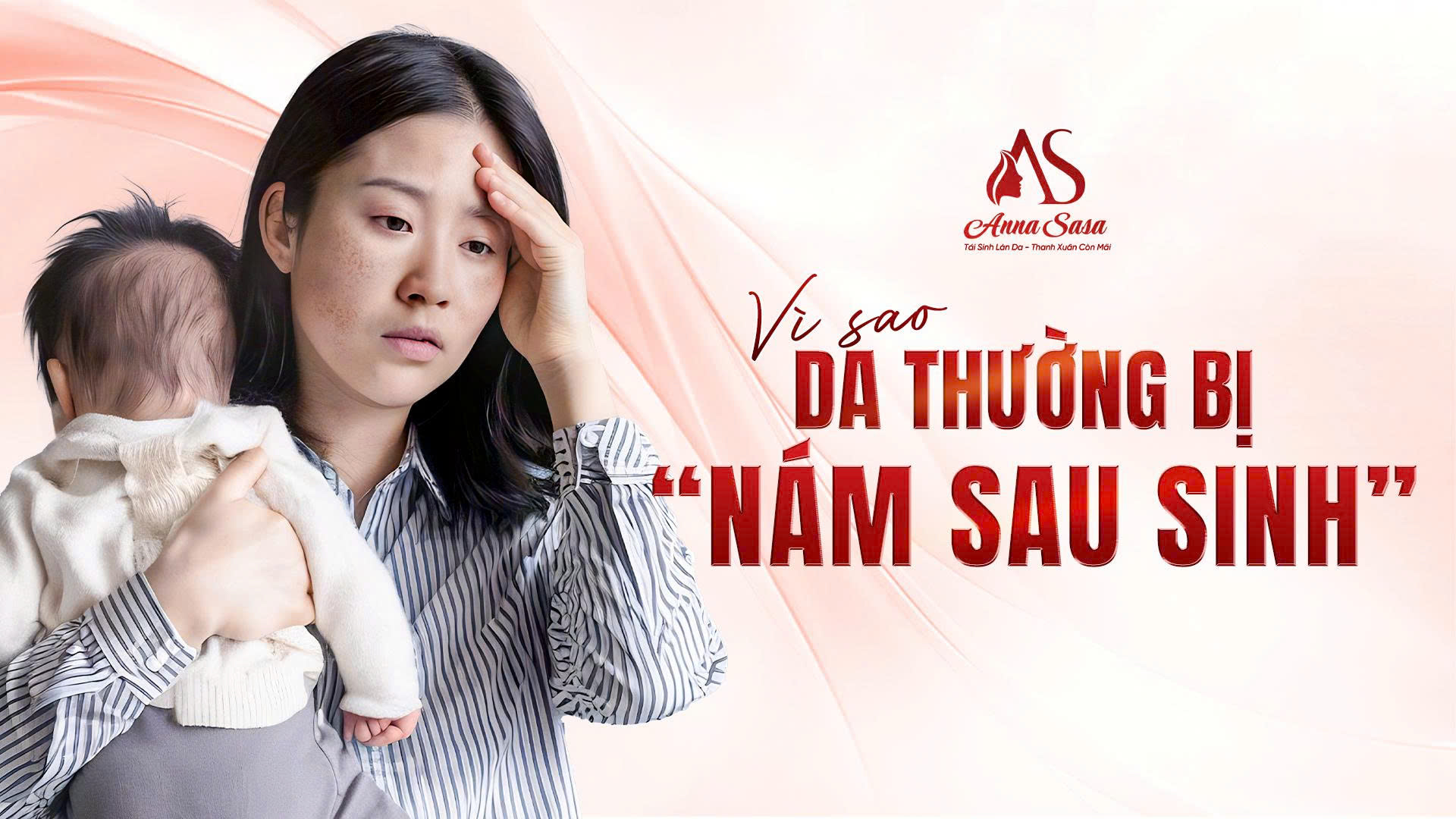 nám sau sinh