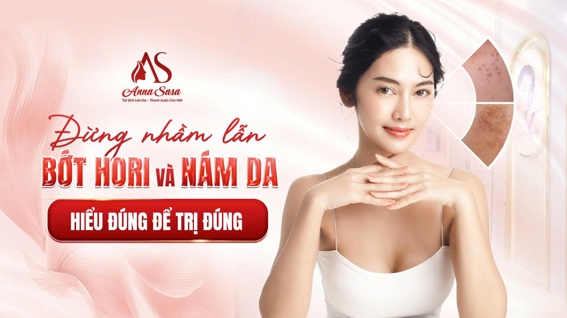 bớt hori
