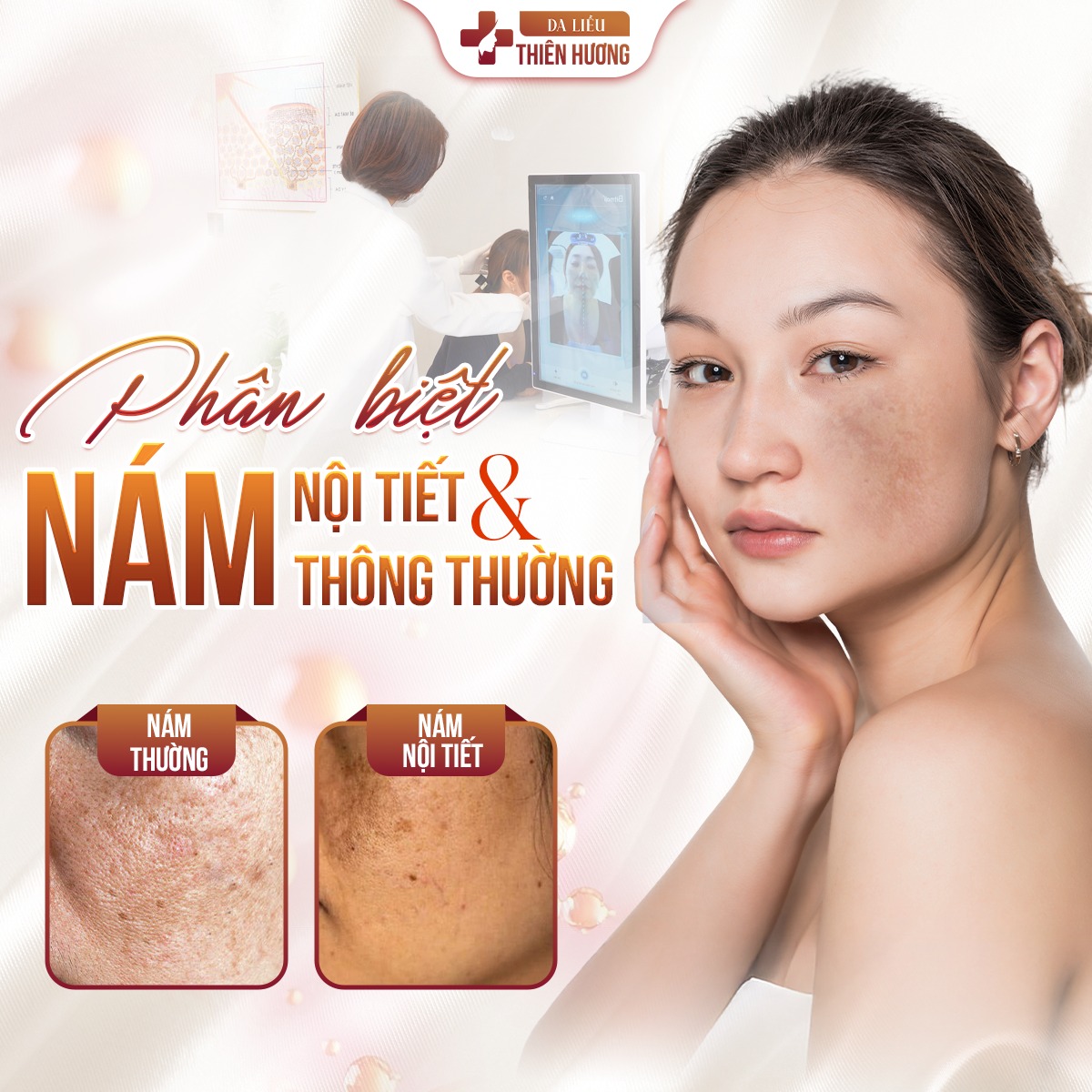 nám nội tiết