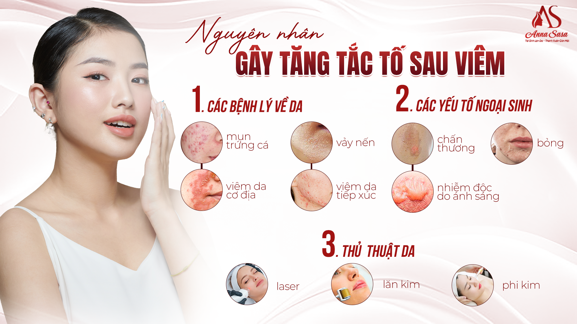 tăng sắc tố