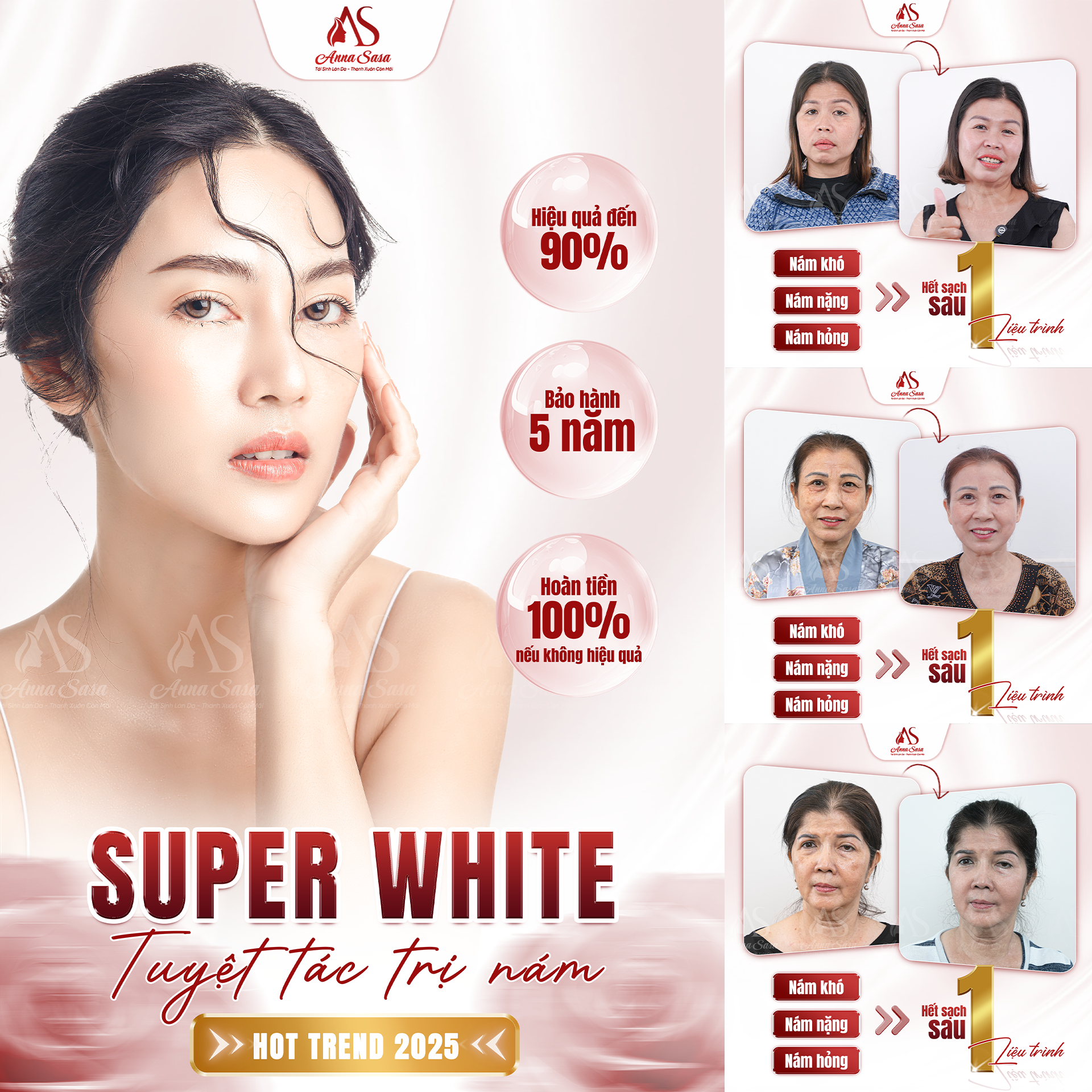 tăng sắc tố