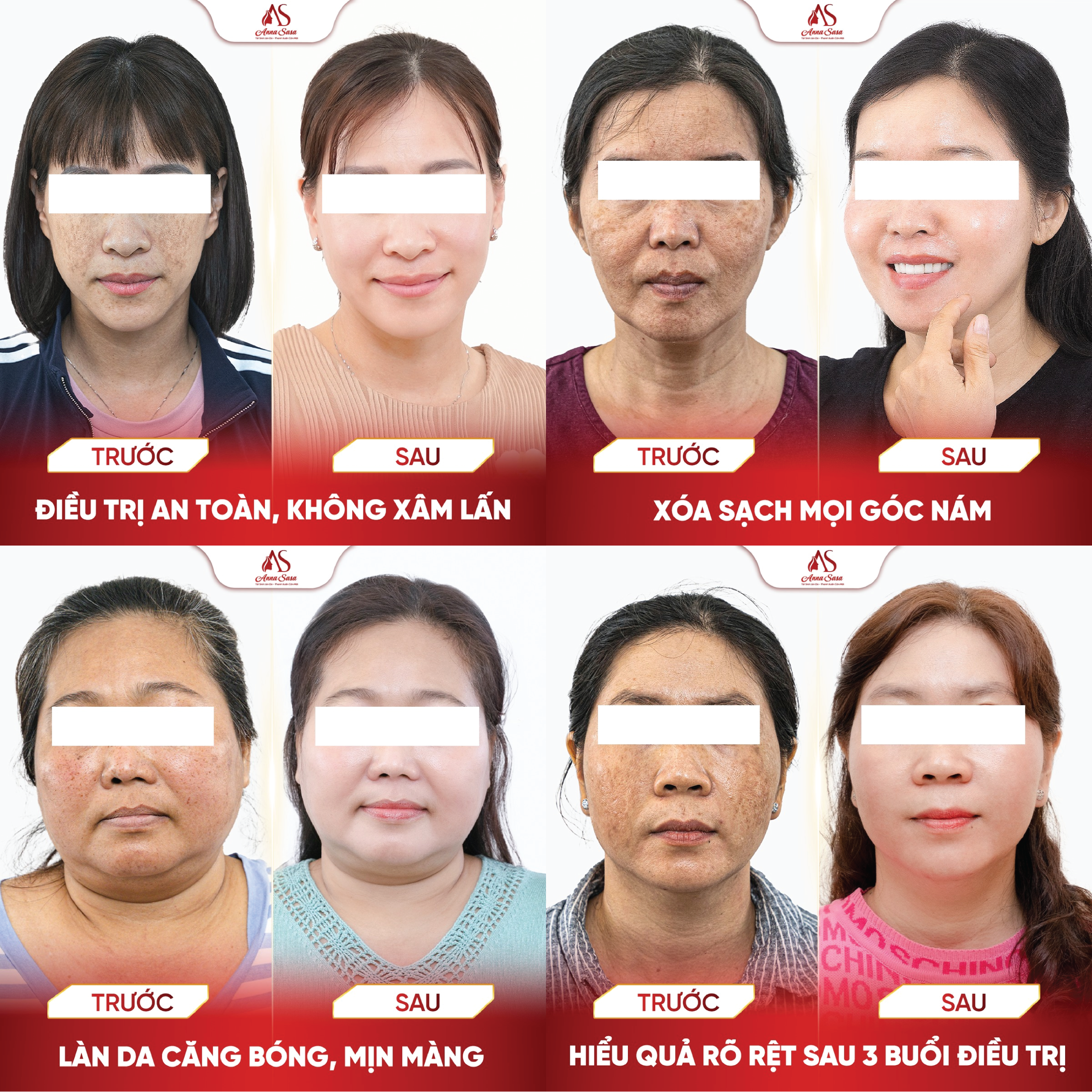 trị nám