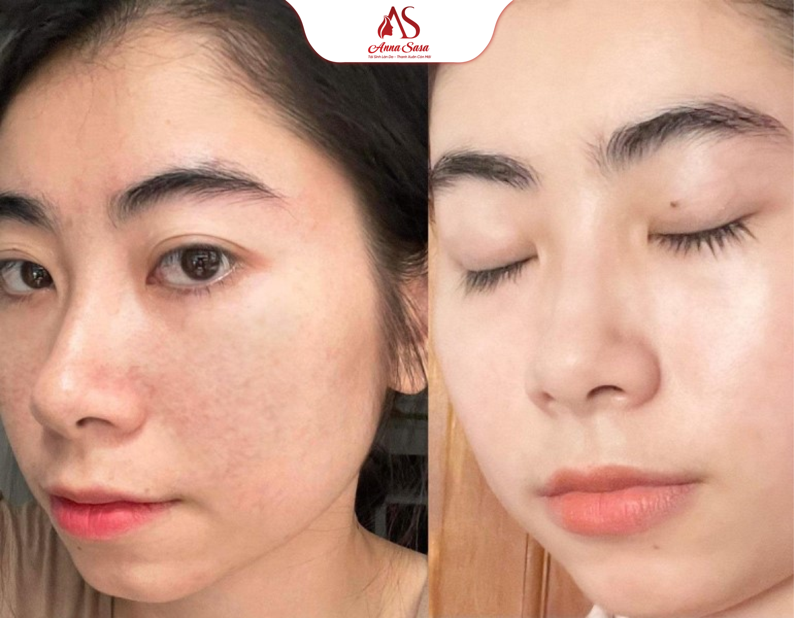 retinol