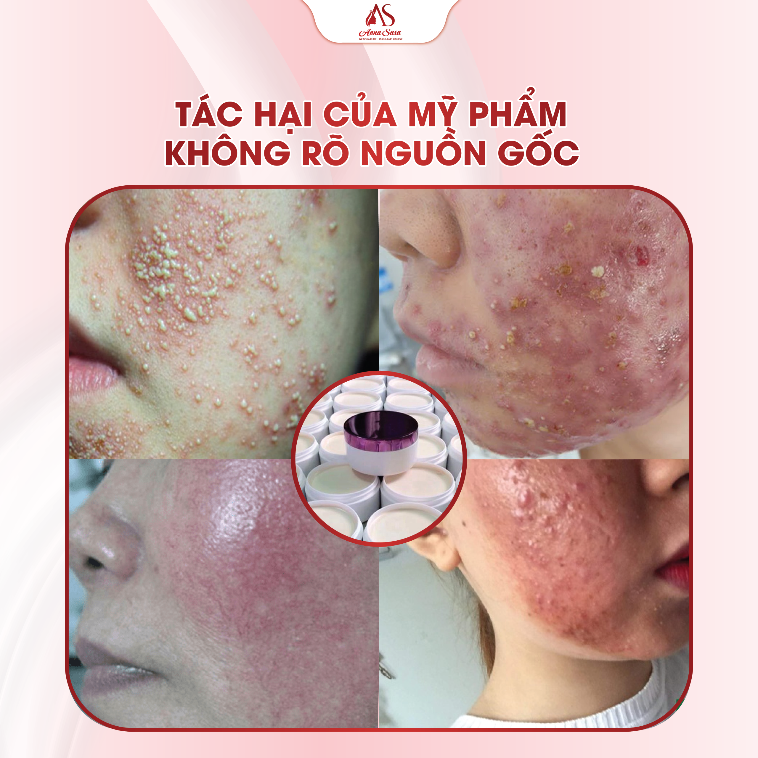 trị nám