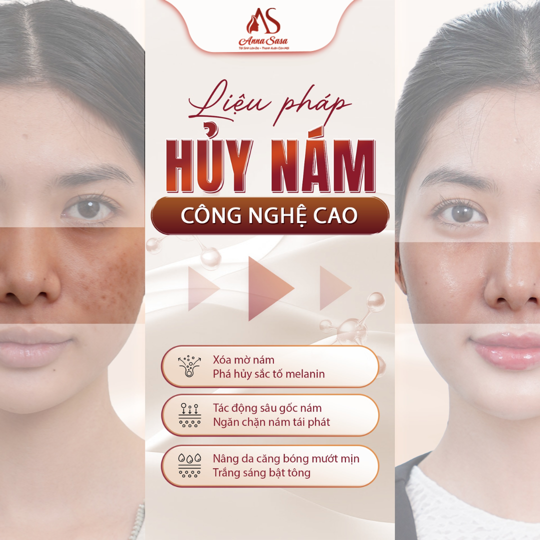 điều trị nám