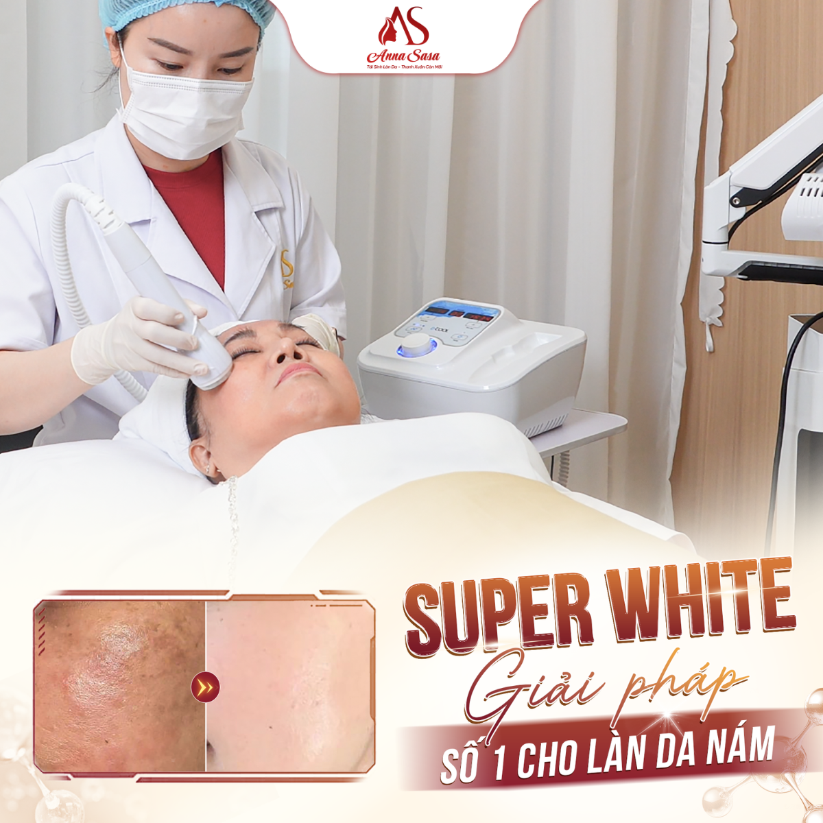 super white