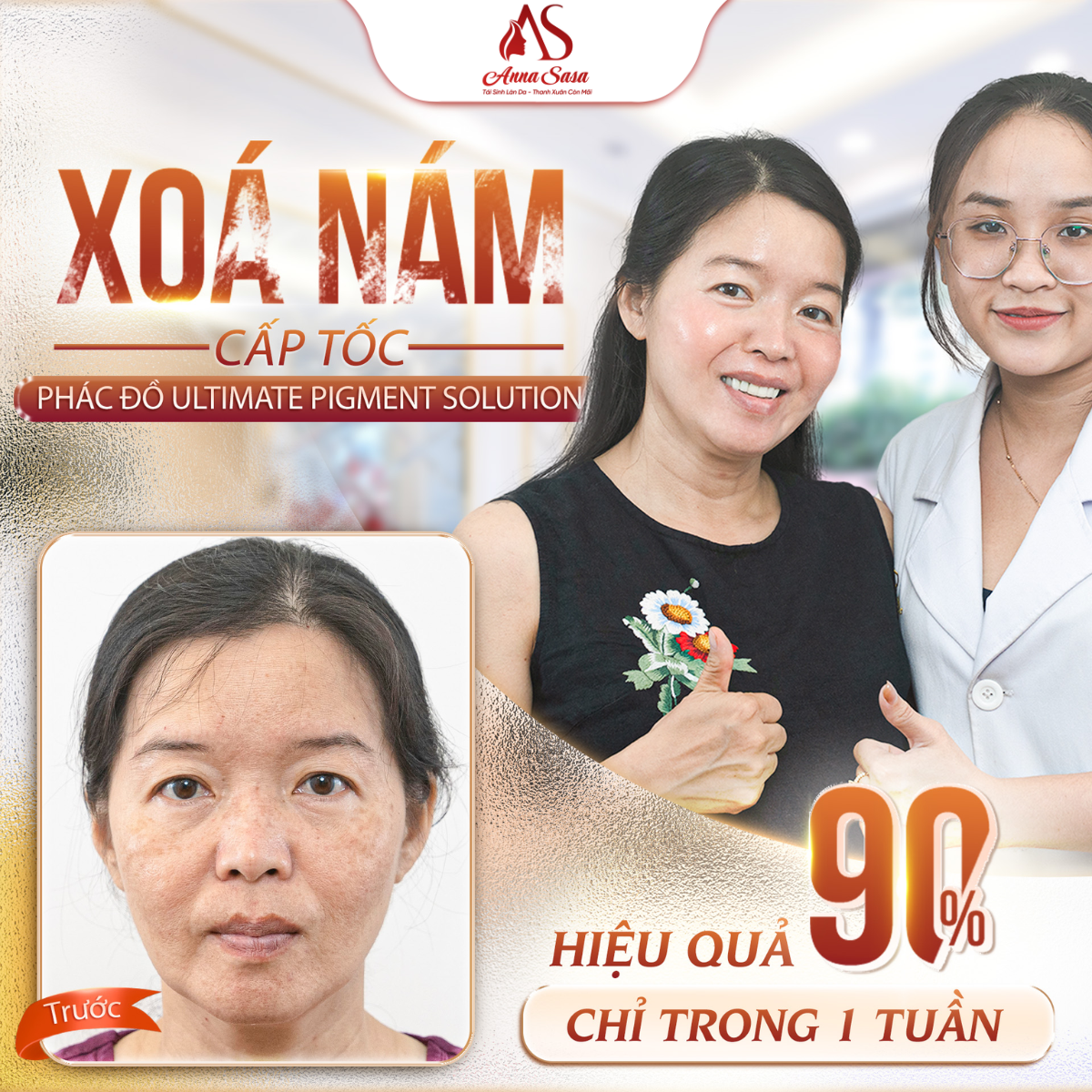trị nám