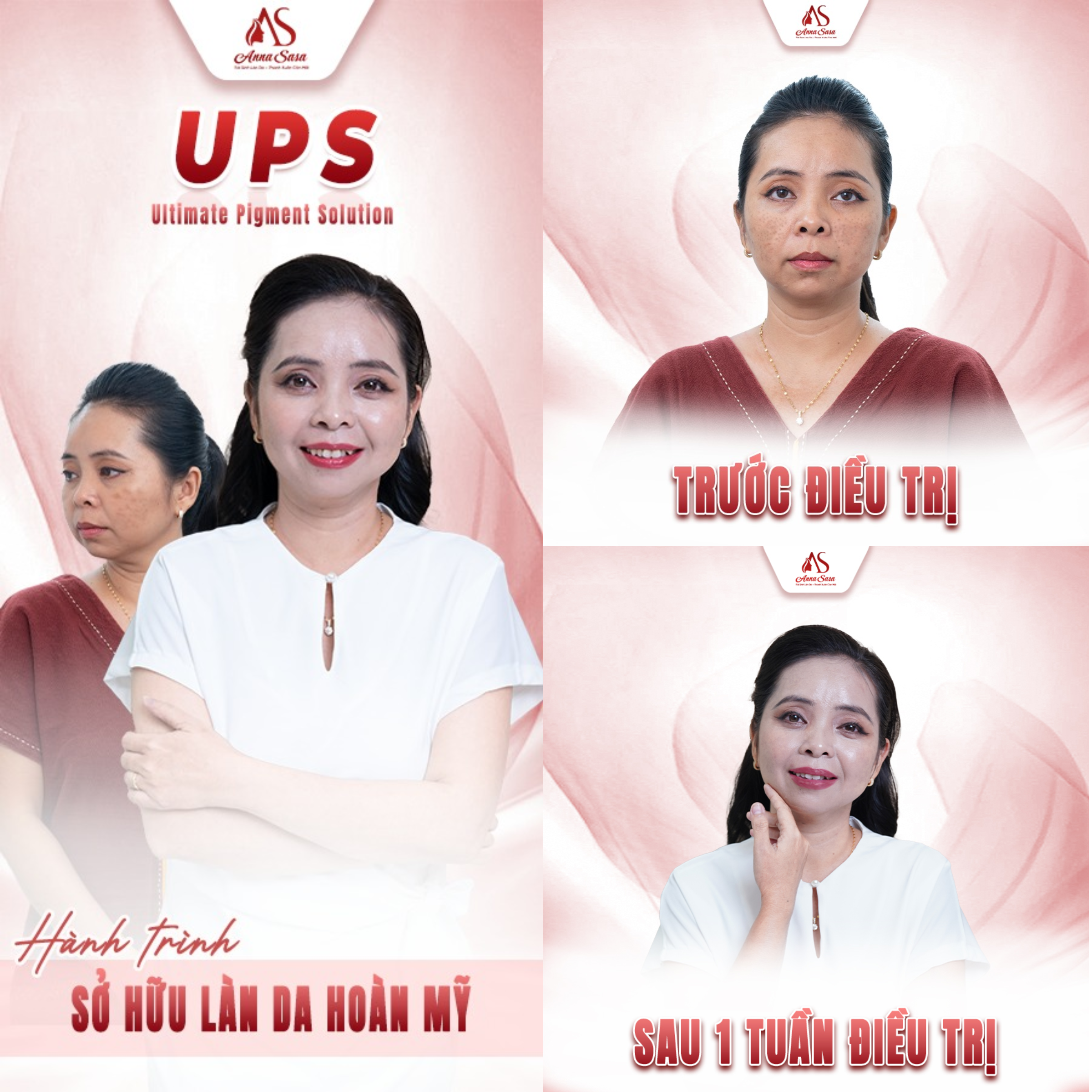 trị nám
