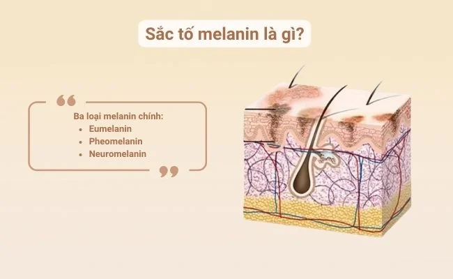 trị nám