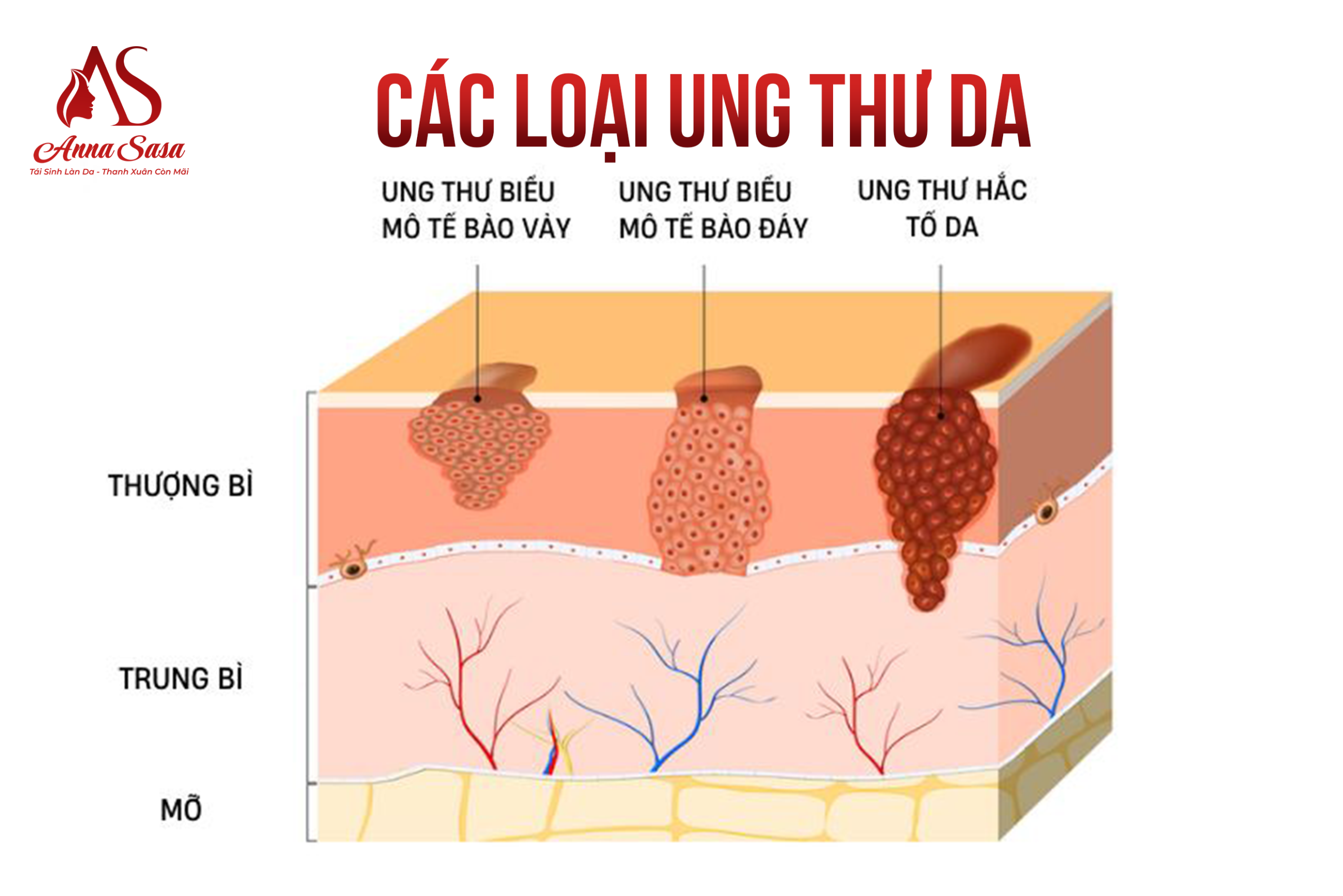 ung thư da