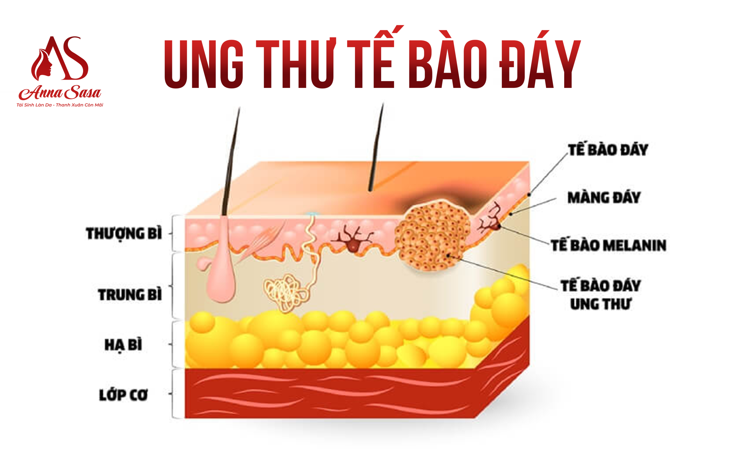 ung thư da