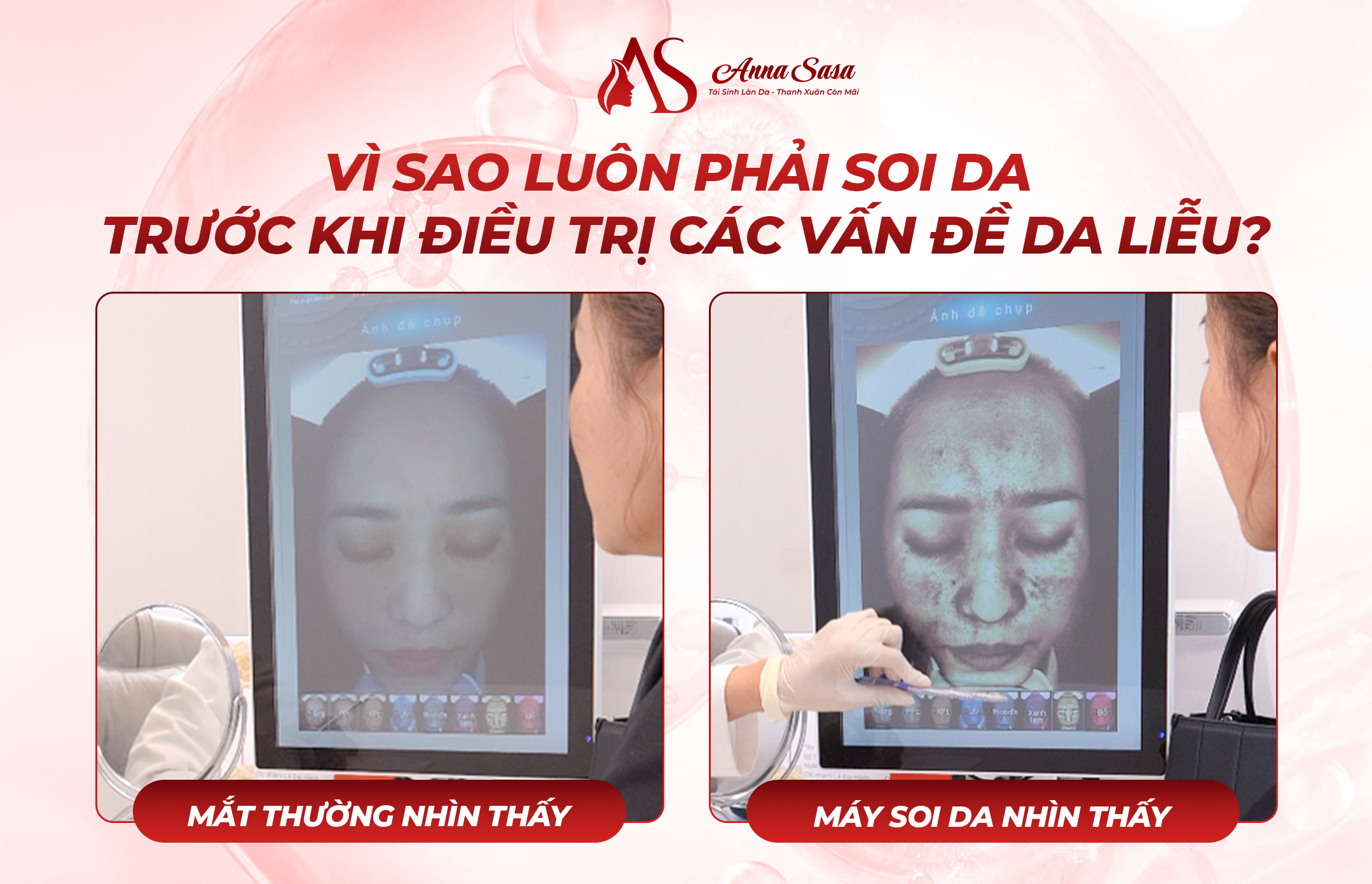 soi da